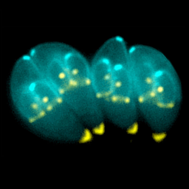 Toxoplasma Gondii, parsito intracelular